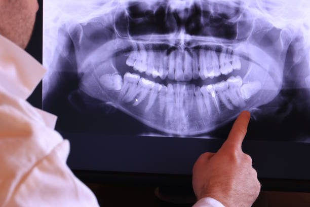 Best Emergency Treatment for Dental Infections or Abscesses in Oakfield, WI