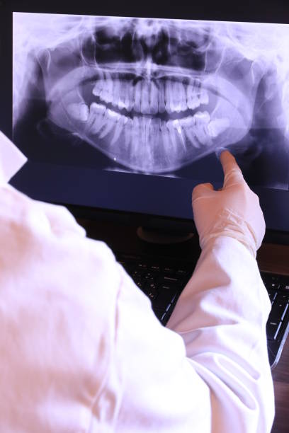 Best Emergency Treatment for Dental Infections or Abscesses in Oakfield, WI